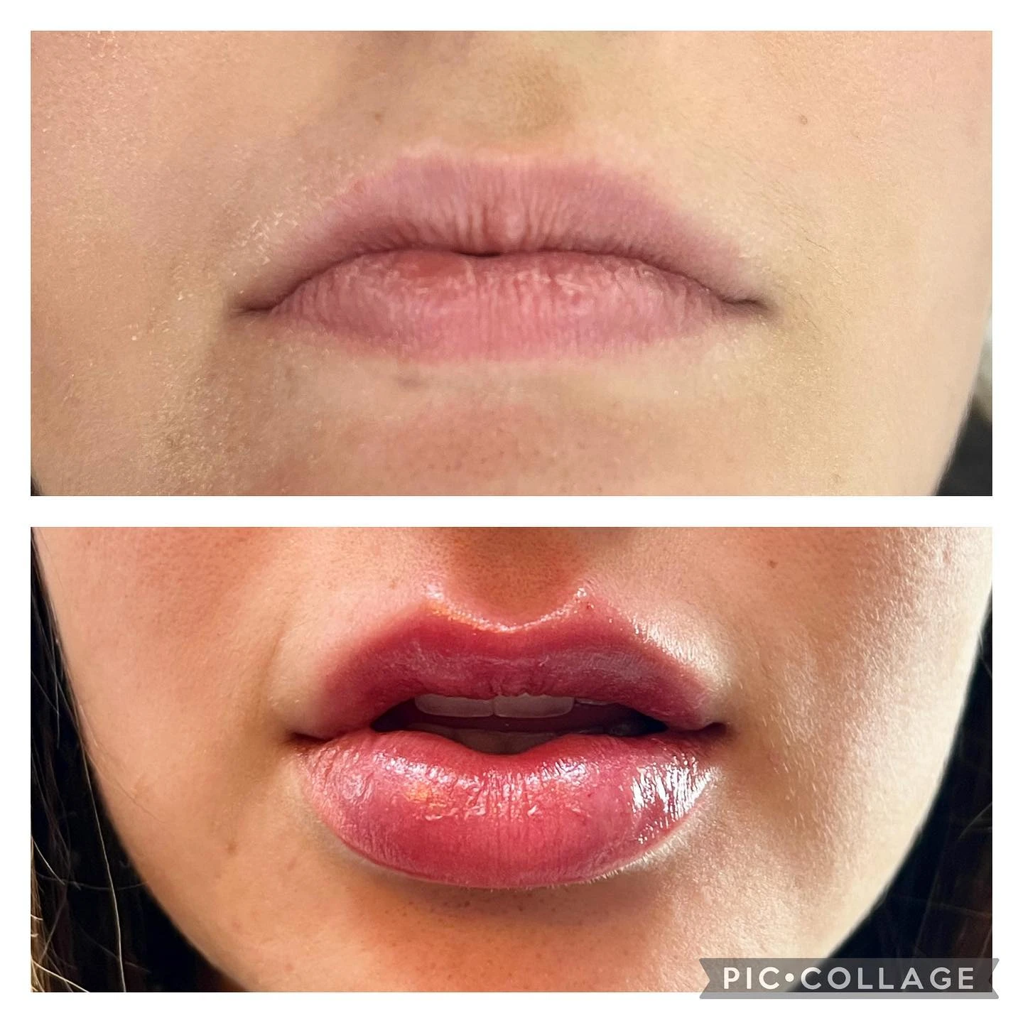 Antes e depois CA Clinic